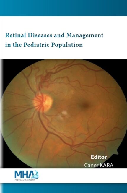 retina