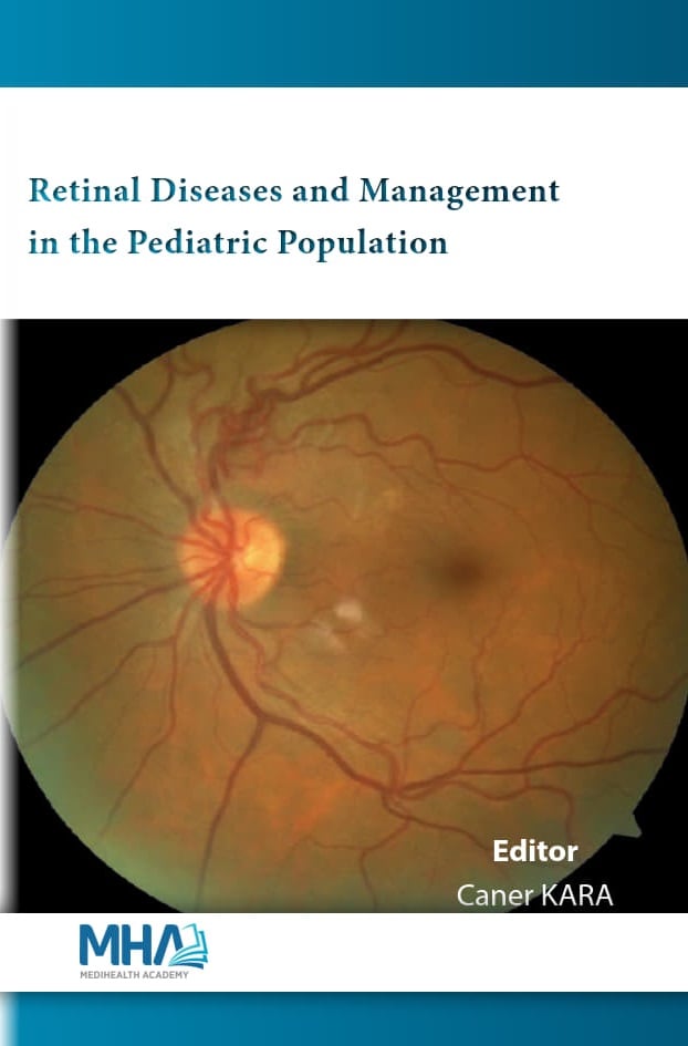 retina